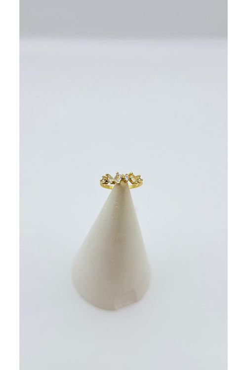 Vip Ayarlanabilir Yüzük